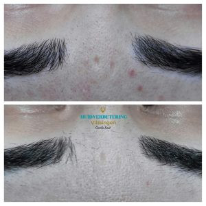 photo - Huidverbetering Vlissingen