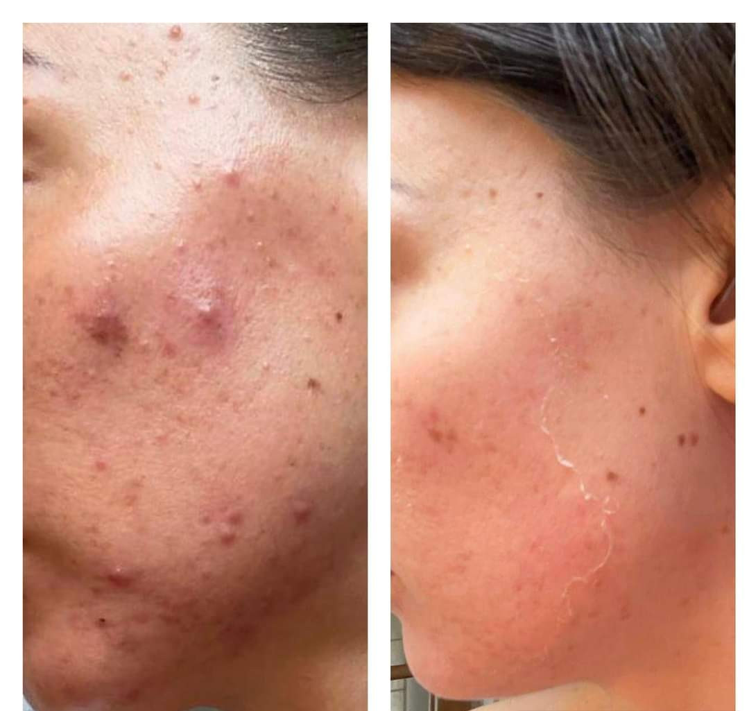 photo - Huidverbetering Vlissingen