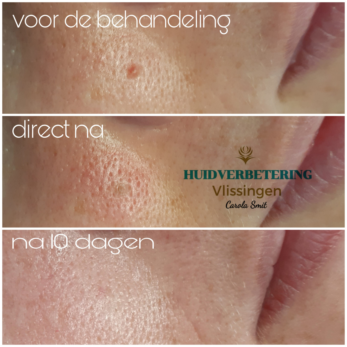 photo - Huidverbetering Vlissingen