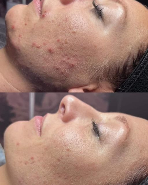 photo - Huidverbetering Vlissingen