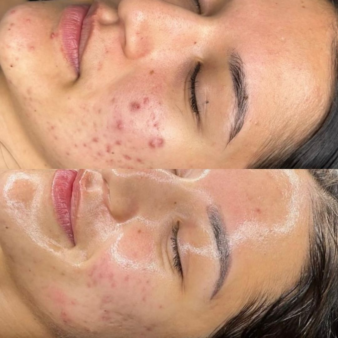 photo - Huidverbetering Vlissingen