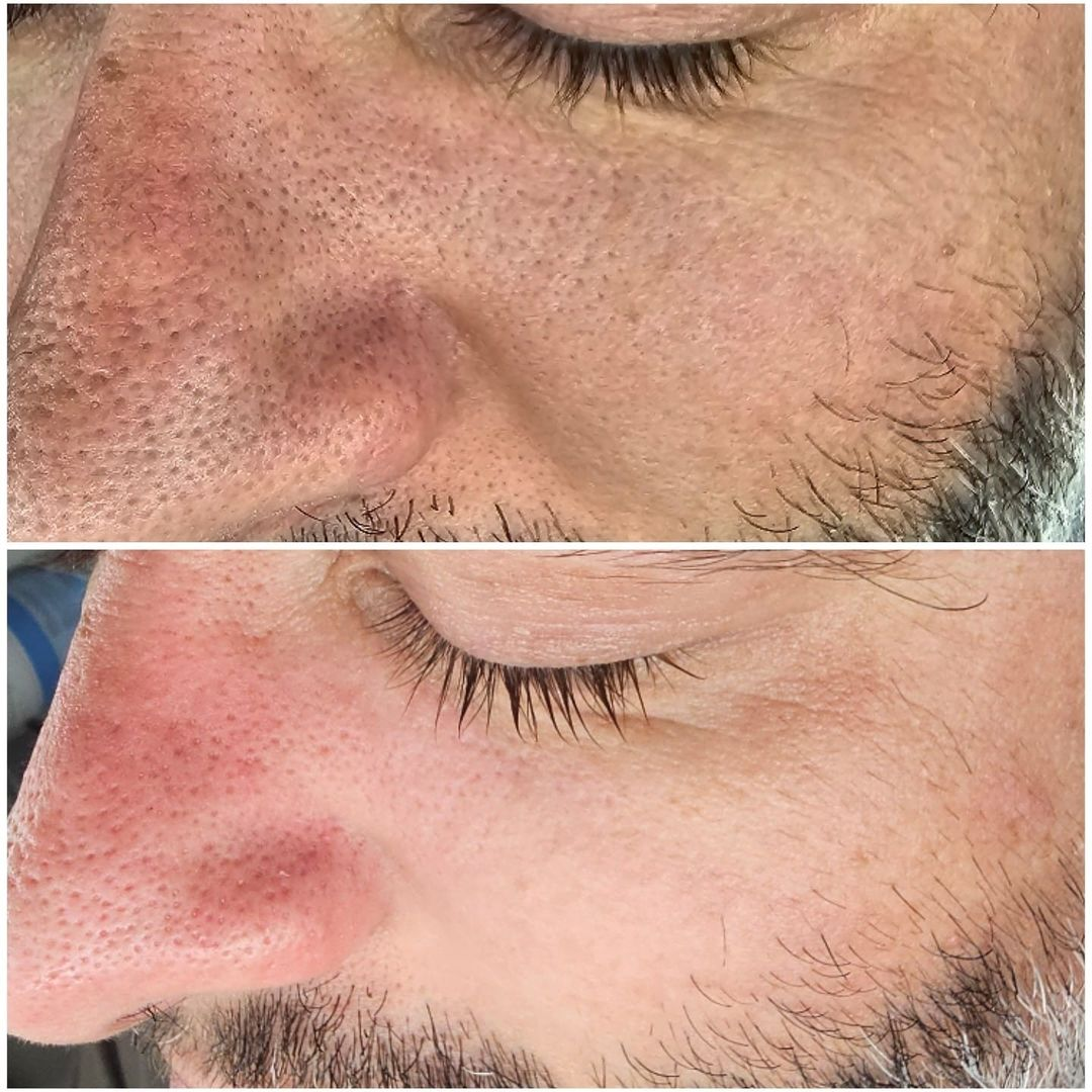 photo - Huidverbetering Vlissingen