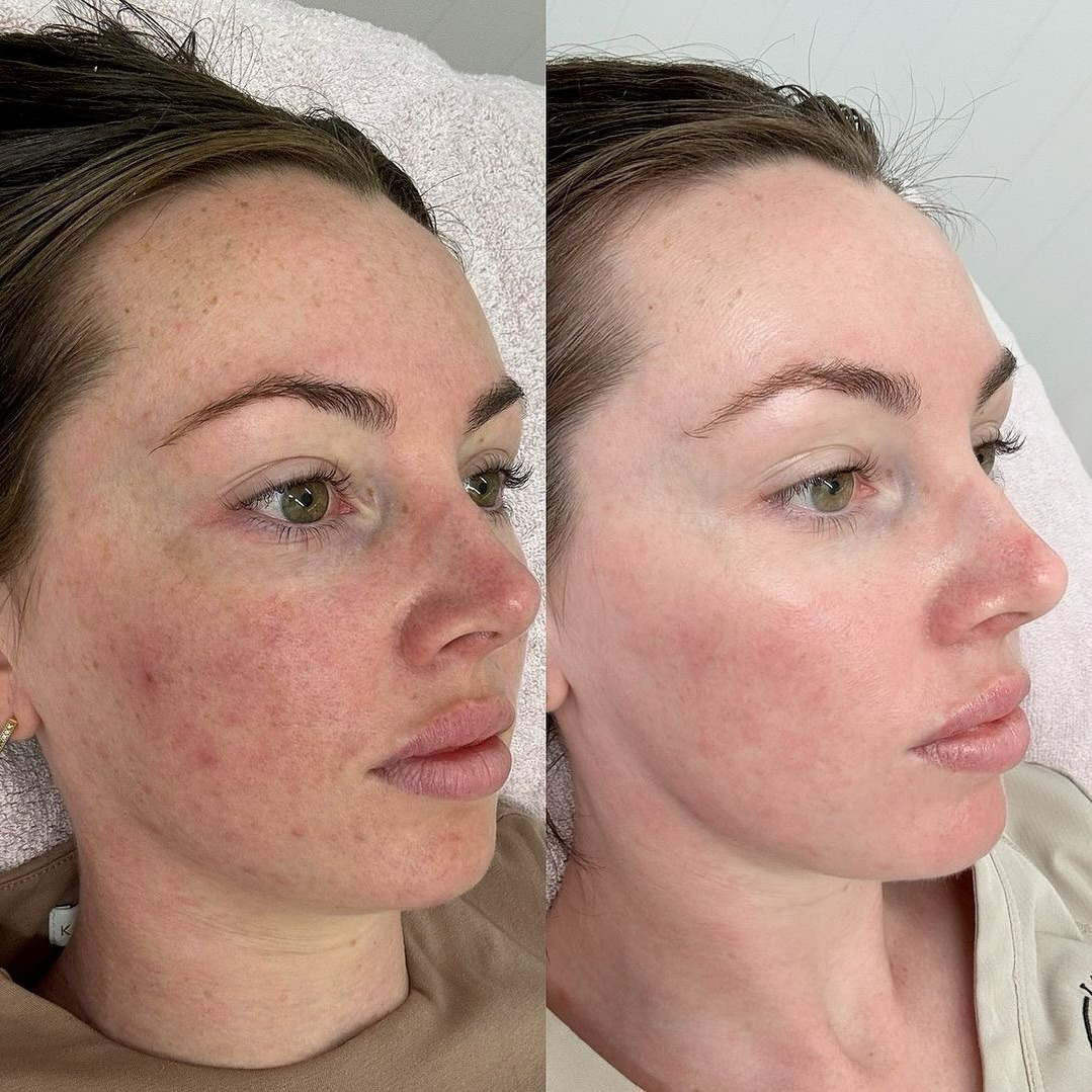 photo - Huidverbetering Vlissingen