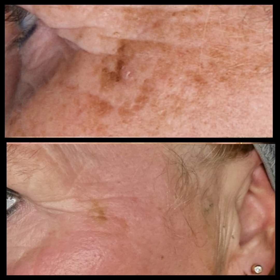 photo - Huidverbetering Vlissingen