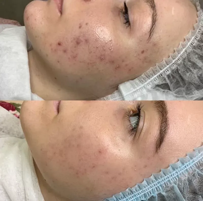 photo - Huidverbetering Vlissingen